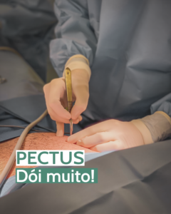 Pectus Dói