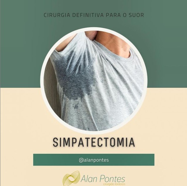 Simpatectomia