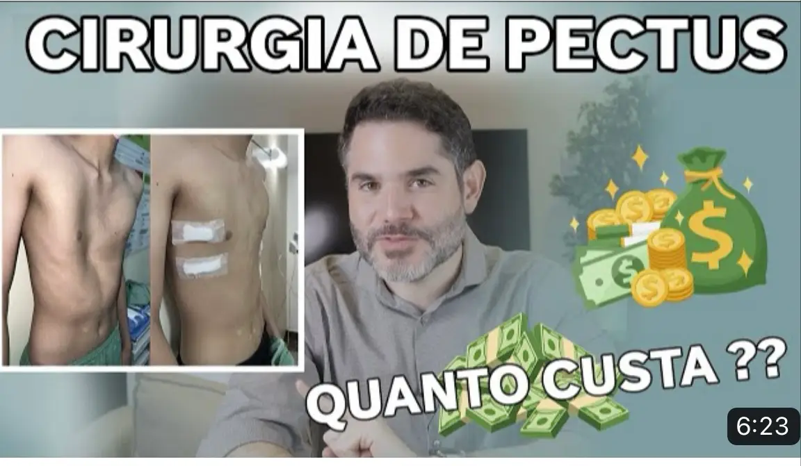 Quanto custa cirurgia de Pectus?